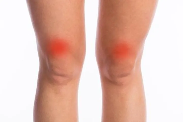 Ból kolan po jeździe na rowerze